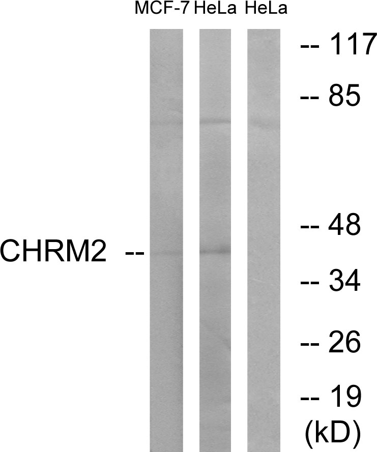 Anti-CHRM2 Antibody