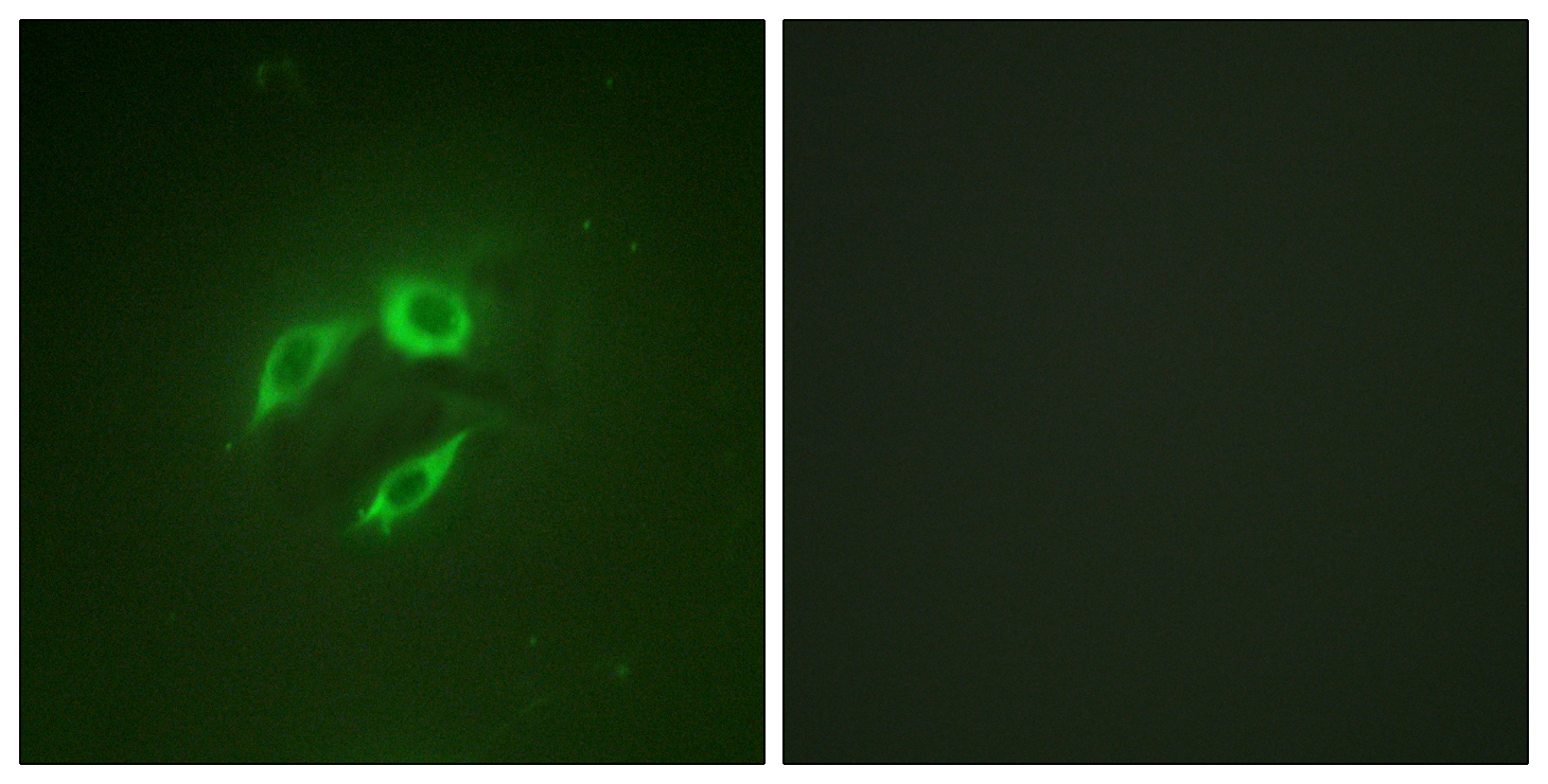 Anti-SEK1 Antibody