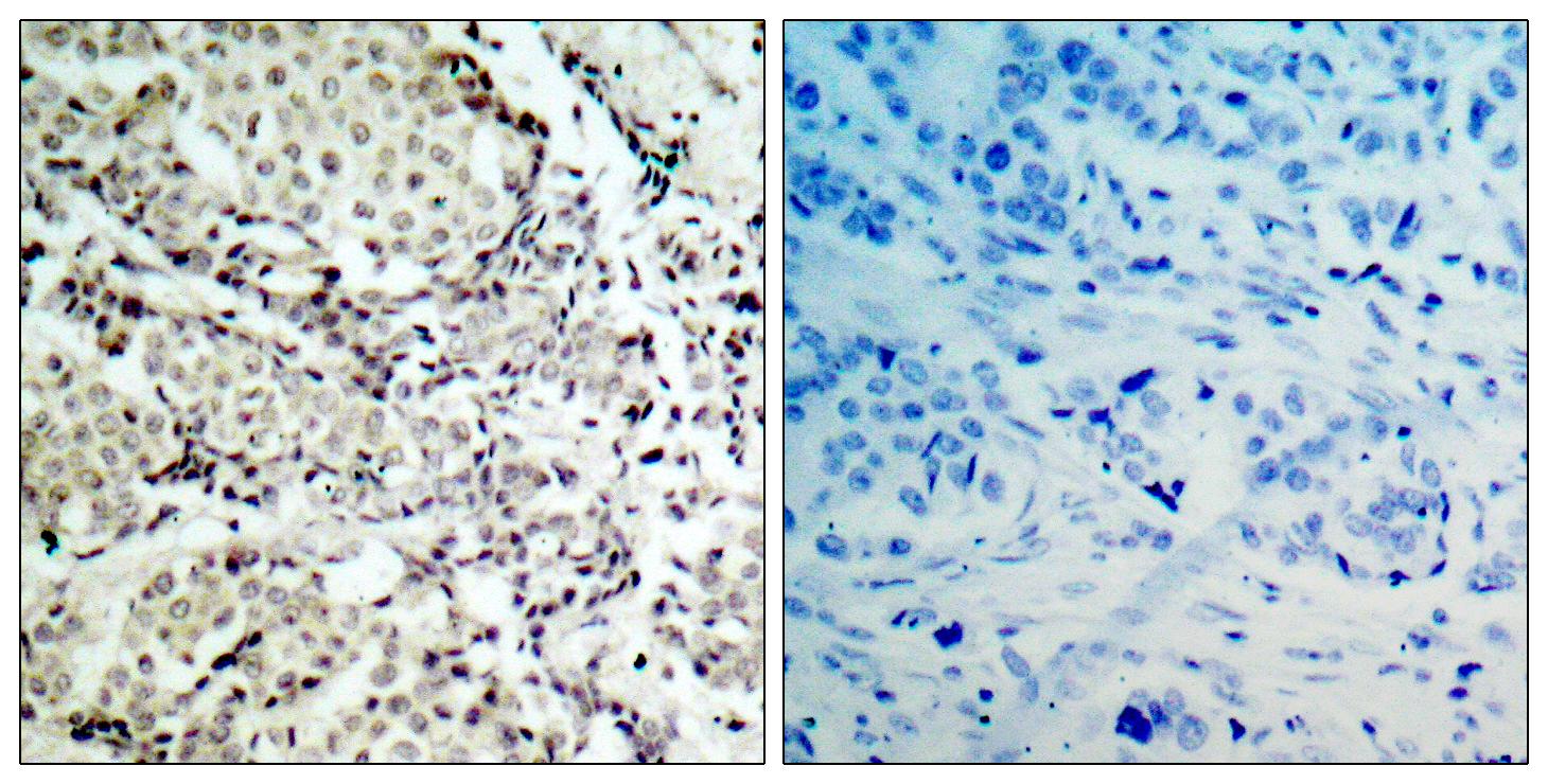 Anti-MKK6 Antibody