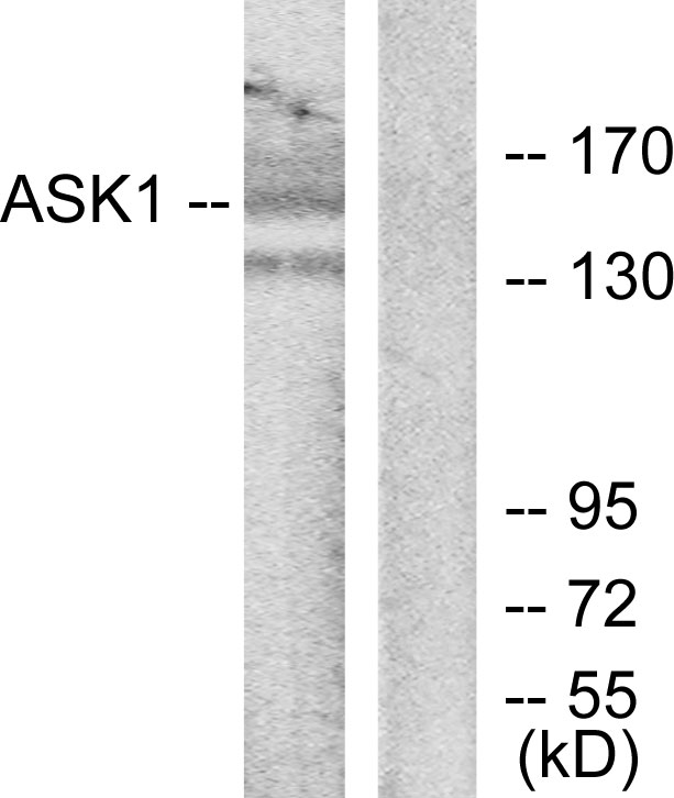 Anti-ASK1 Antibody - Identical to Abcam (ab131506)