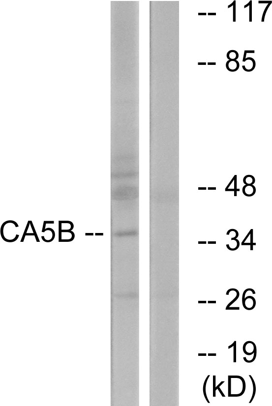 Anti-CA5B Antibody - Identical to Abcam (ab196800)