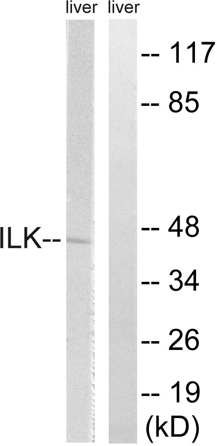 Anti-ILK Antibody