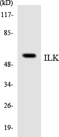 Anti-ILK Antibody