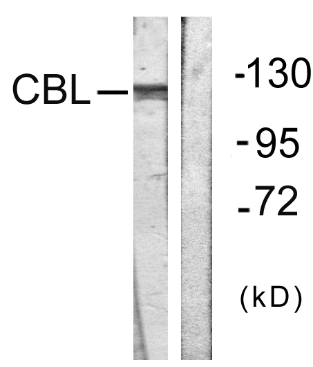 Anti-CBL Antibody