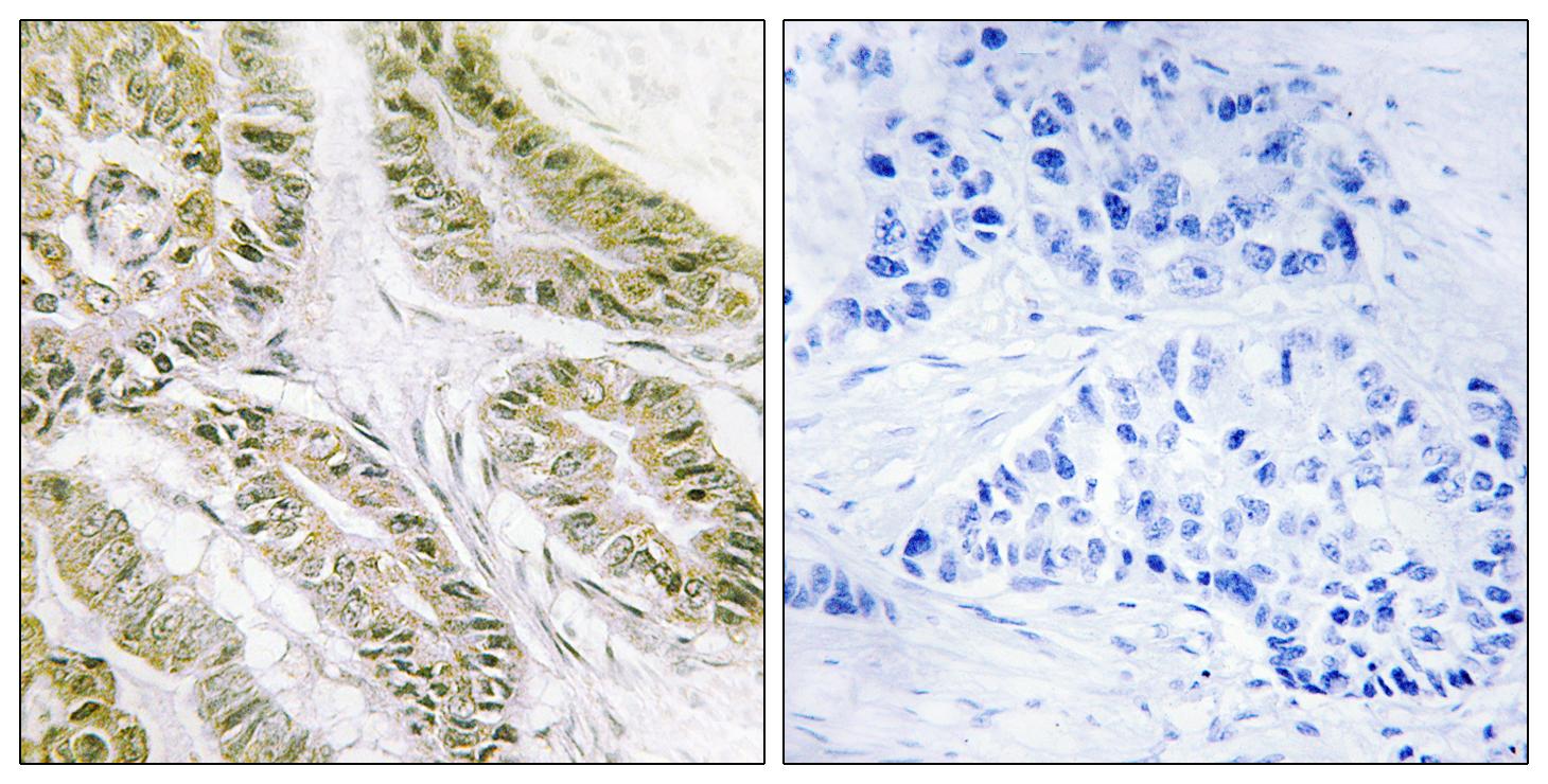 Anti-BAX Antibody - Identical to Abcam (ab53154)