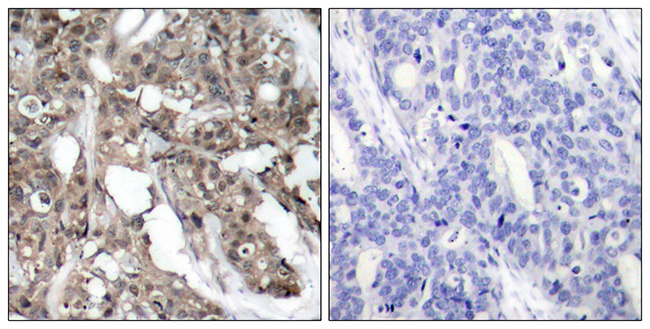 Anti-Akt Antibody