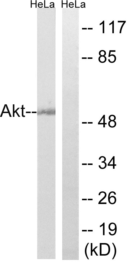 Anti-Akt Antibody