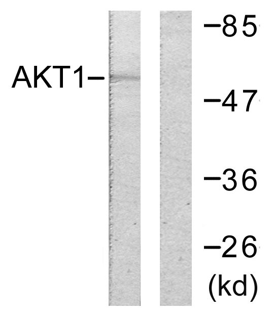 Anti-Akt Antibody