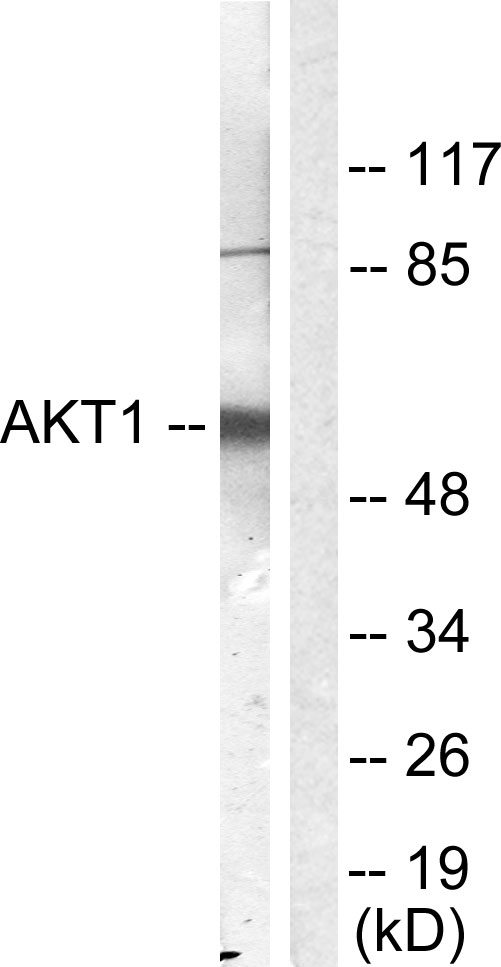 Anti-Akt Antibody