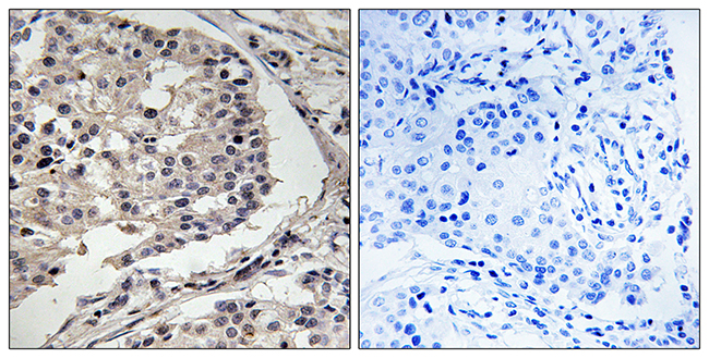 Anti-MLK1 + MLK2 Antibody