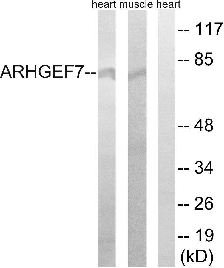 Anti-ARHGEF7 Antibody