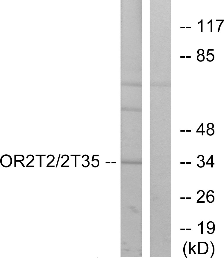 Anti-OR2T2 + OR2T35 Antibody