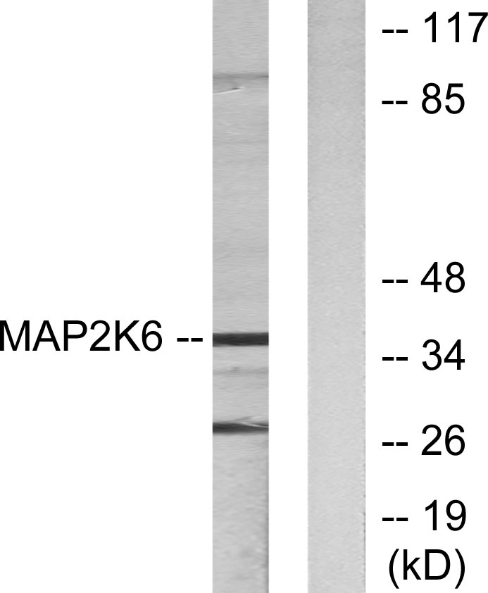 Anti-MAP2K6 Antibody