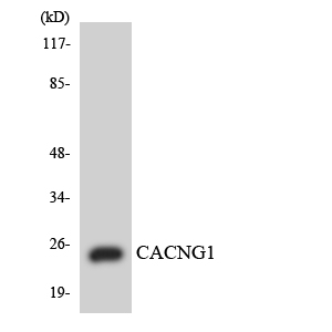 Anti-CACNG1 Antibody