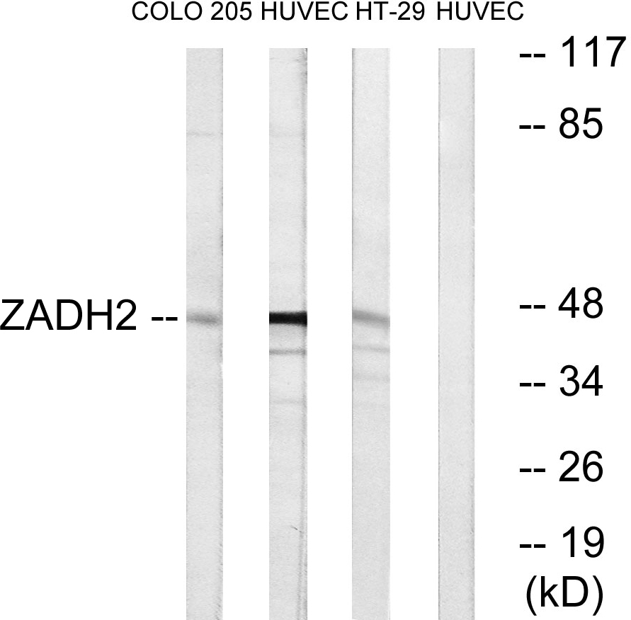 Anti-ZADH2 Antibody