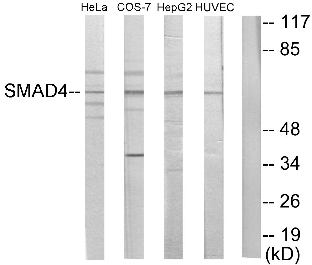 Anti-Smad4 Antibody