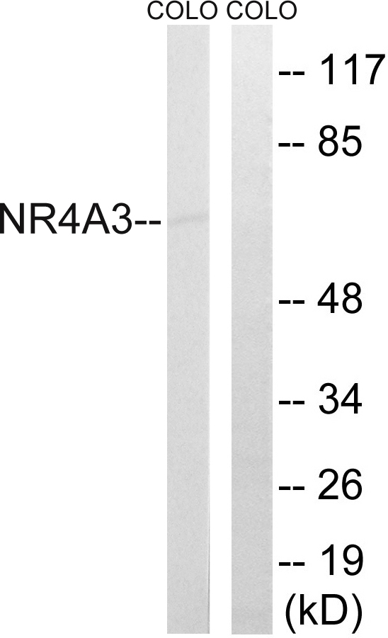 Anti-NR4A3 Antibody
