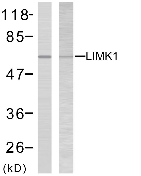 Anti-LIMK2 Antibody