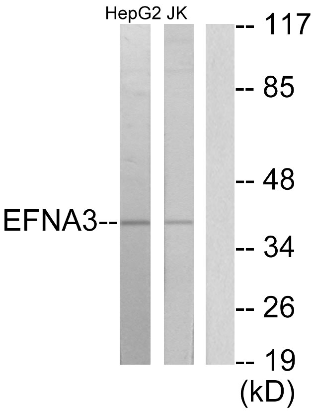 Anti-EFNA3 Antibody