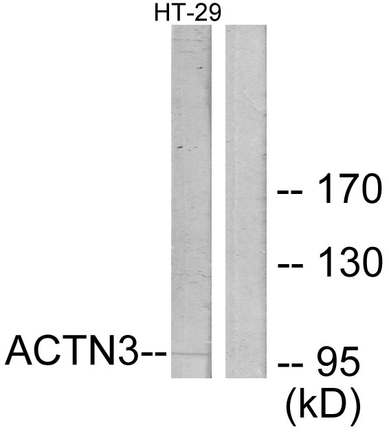 Anti-ACTN3 Antibody