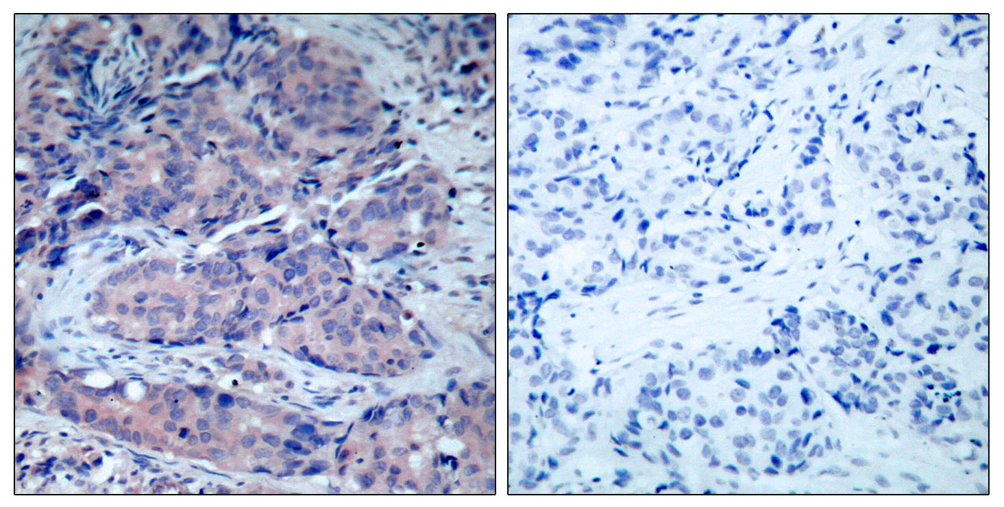 Anti-SEK1 Antibody - Identical to Abcam (ab131494)