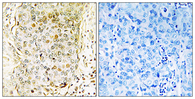 Anti-MLK3 Antibody