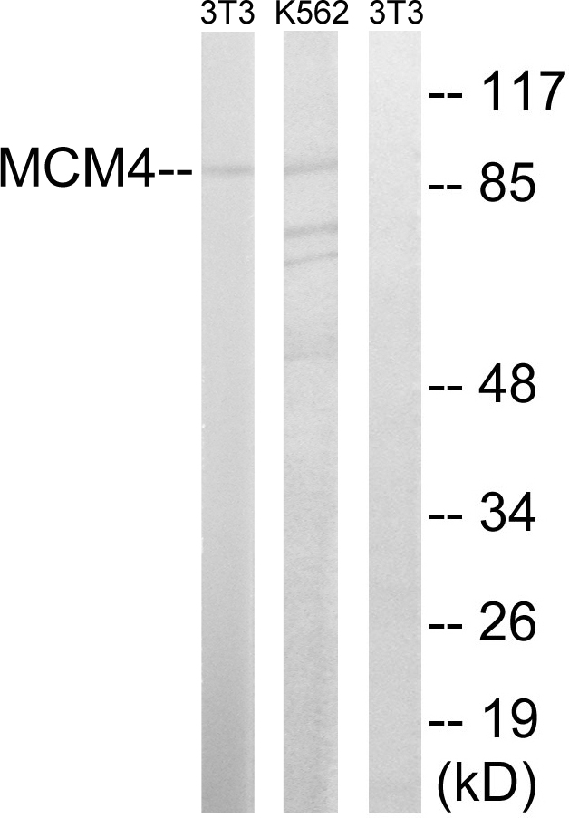 Anti-MCM4 Antibody