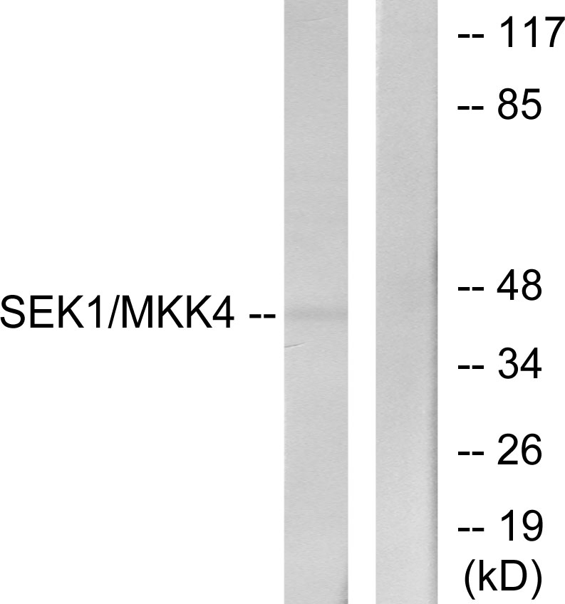 Anti-SEK1 Antibody