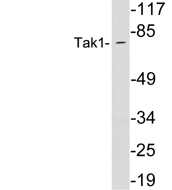 Anti-Tak1 Antibody