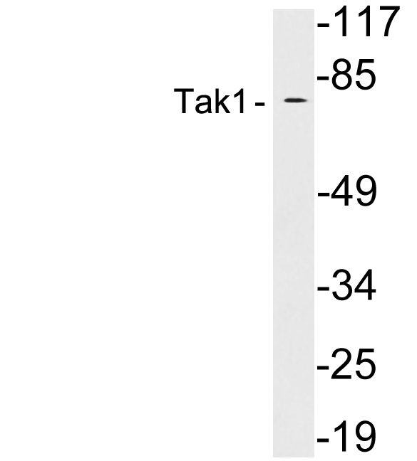 Anti-Tak1 Antibody