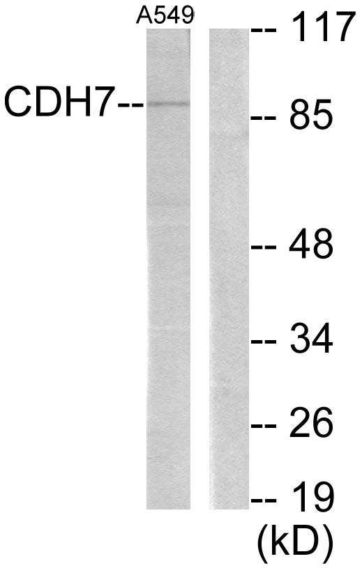 Anti-CDH7 Antibody