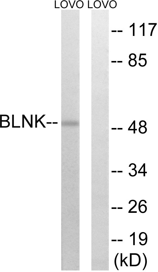 Anti-BLNK Antibody