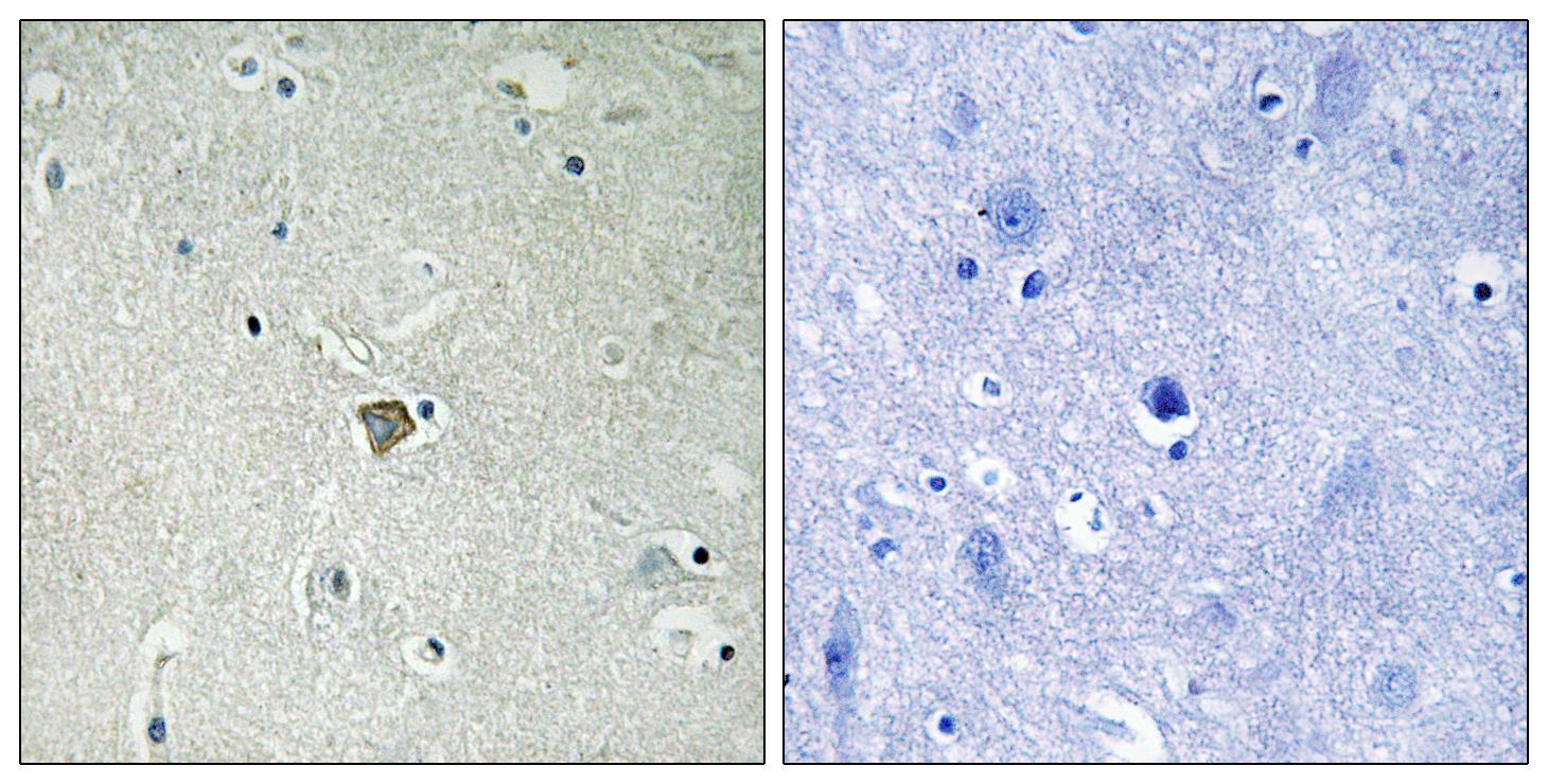 Anti-Bax Antibody