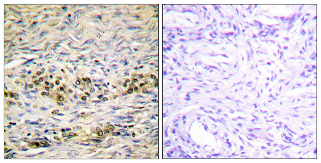 Anti-Akt Antibody