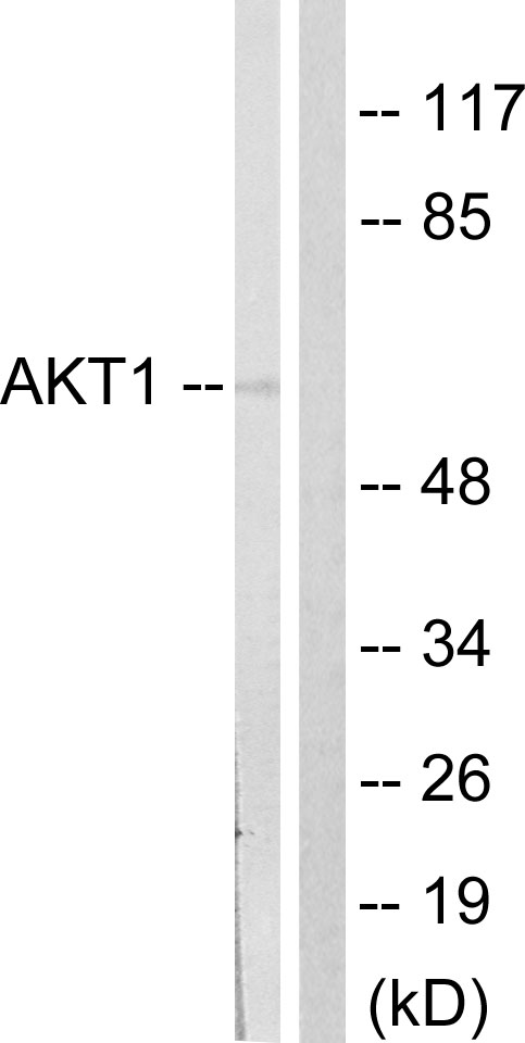 Anti-Akt Antibody