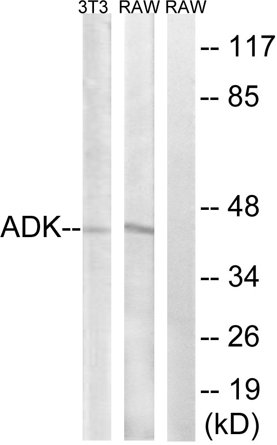 Anti-ADK Antibody