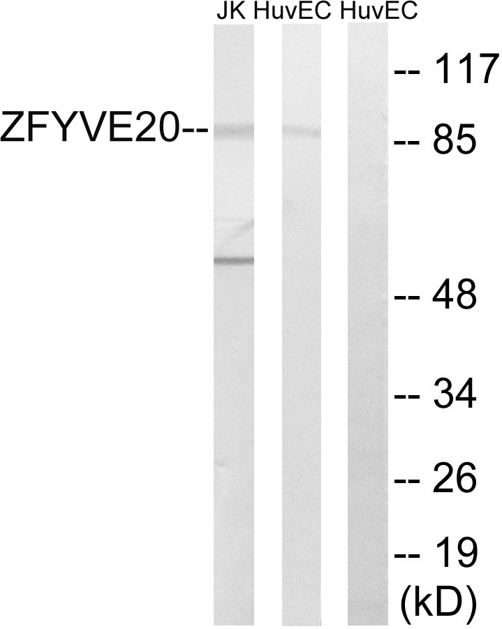 Anti-ZFYVE20 Antibody