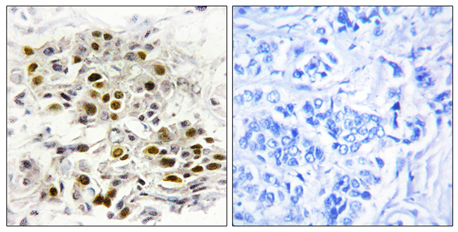 Anti-MAP3K6 Antibody - Identical to Abcam (ab111252)