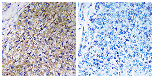 Anti-GOLT1A Antibody