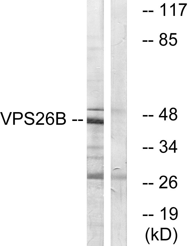 Anti-VPS26B Antibody