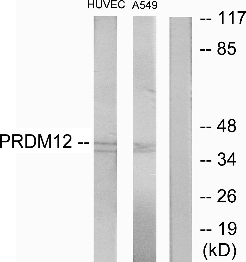 Anti-PRDM12 Antibody