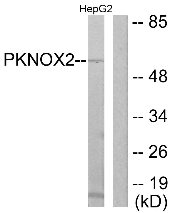 Anti-PKNOX2 Antibody