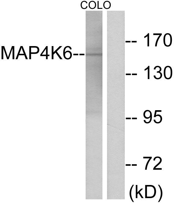 Anti-MAP4K6 Antibody