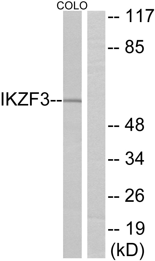 Anti-IKZF3 Antibody