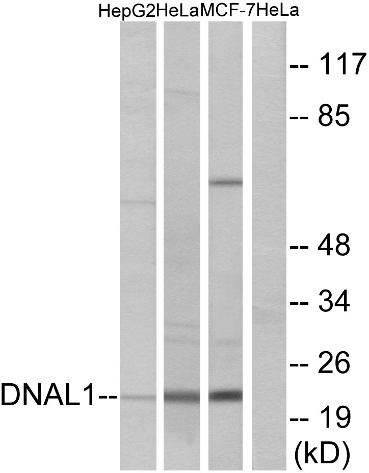 Anti-DNAL1 Antibody