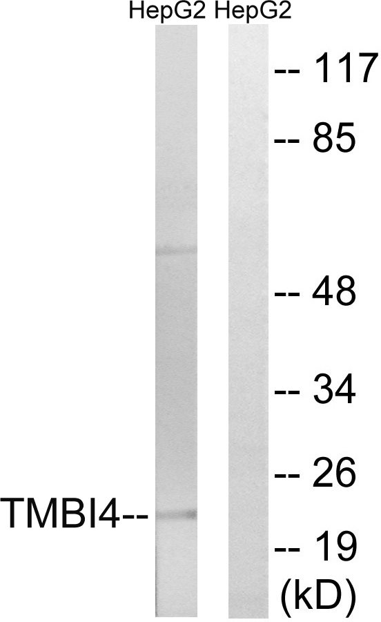 Anti-TMBIM4 Antibody