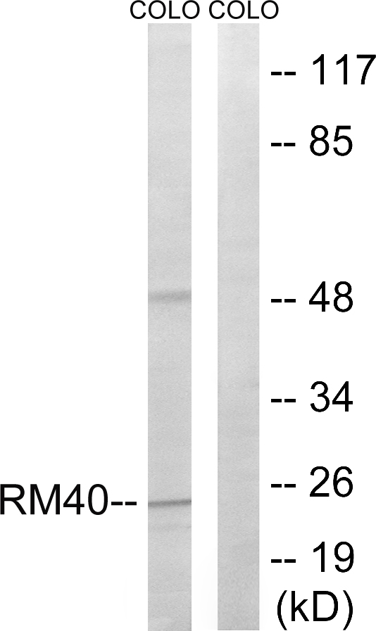 Anti-MRPL40 Antibody