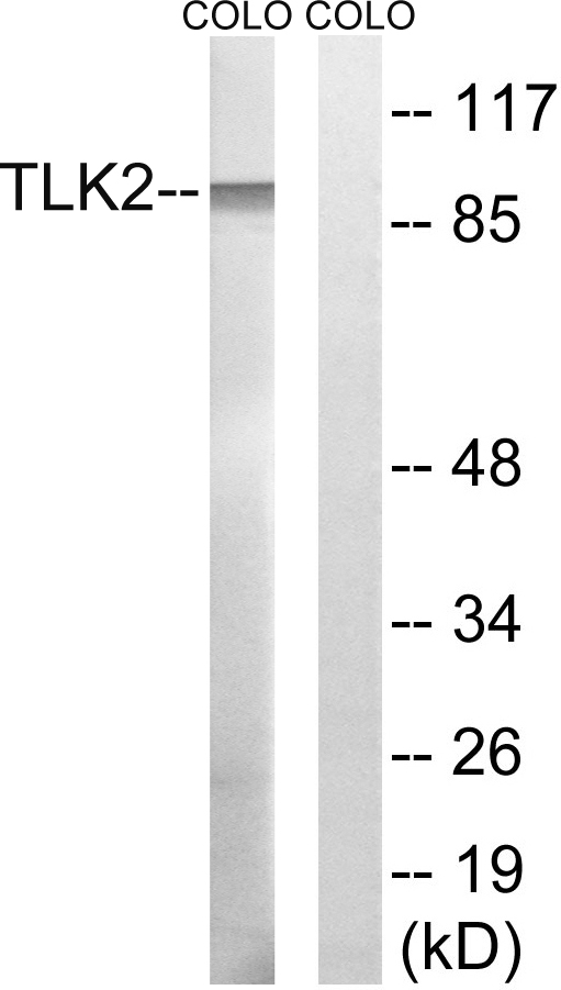 Anti-TLK2 Antibody