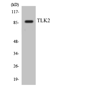 Anti-TLK2 Antibody