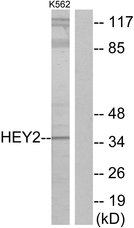 Anti-HEY2 Antibody